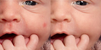 Newborn skin before & after 4