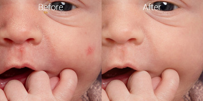 Newborn skin before & after 4