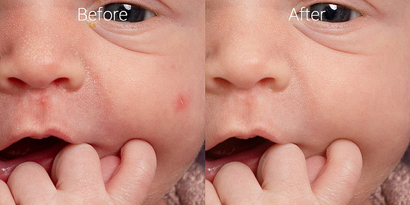 Newborn skin before & after 4