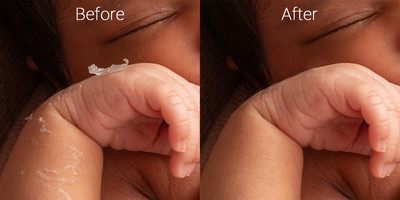 Newborn skin before & after 3