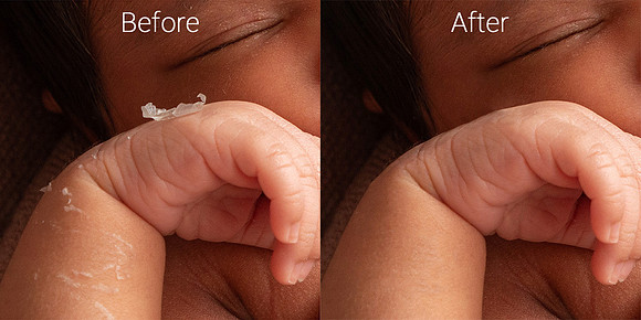 Newborn skin before & after 3