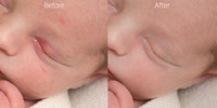 Newborn skin before & after 1
