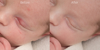 Newborn skin before & after 1