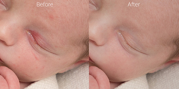 Newborn skin before & after 1