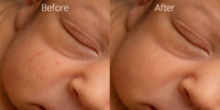 Newborn skin before & after 2