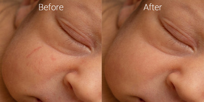 Newborn skin before & after 2